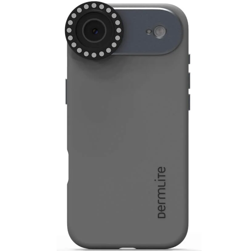 Dermlite-forbindelsessæt til iPhone 17 Air