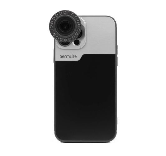 DermLite-forbindelsessæt til iPhone 14 Pro Max