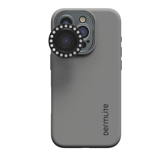 Dermlite-forbindelsessæt til iPhone 16e