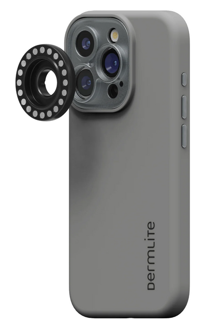 Dermlite-forbindelsessæt til iPhone 16 Plus