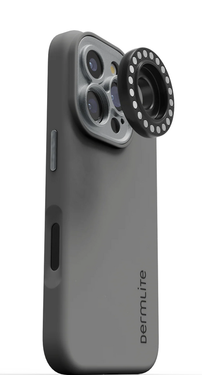 Dermlite-forbindelsessæt til iPhone 16